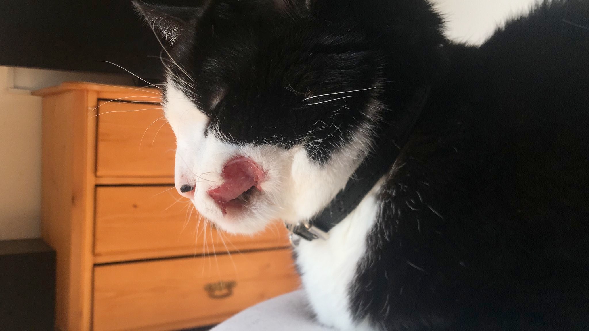 Plattenepithelkarzinom mittleres Stadium